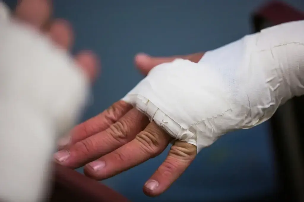 Close-up of a worker's bandaged hand after a workplace injury, before being fired for filing workers comp